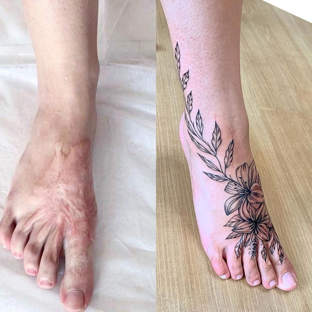 Татуировка поверх шрама на ноге