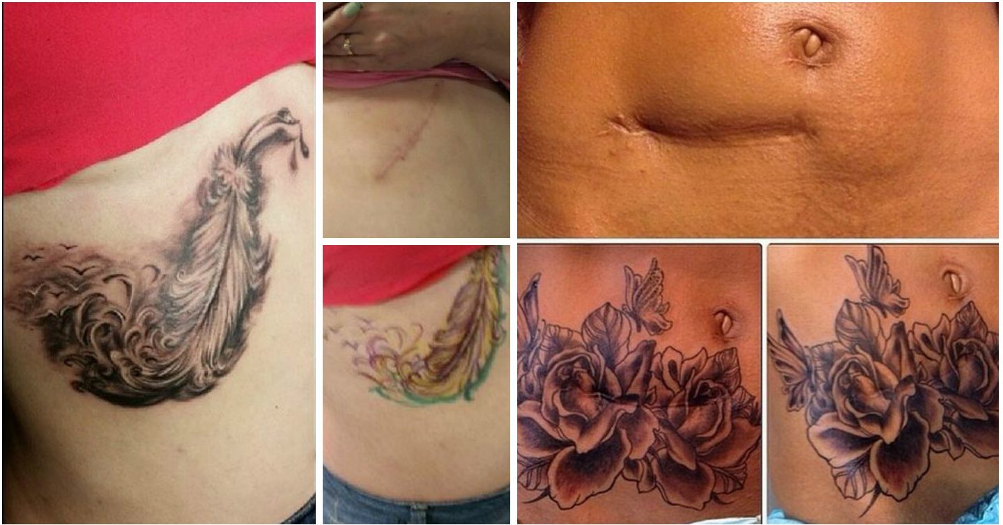 Татуировки женские на животе на шраме
