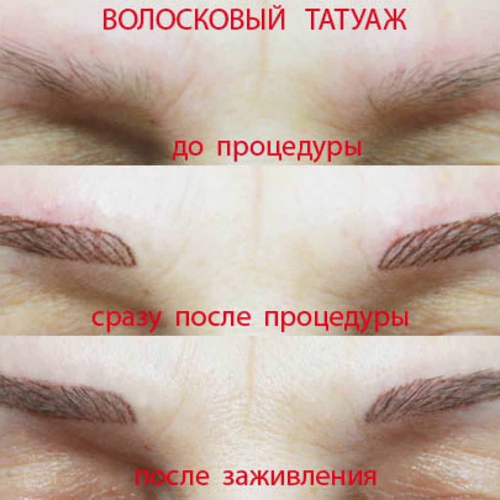 Волосковая техника бровей перманентного макияжа зажившие
