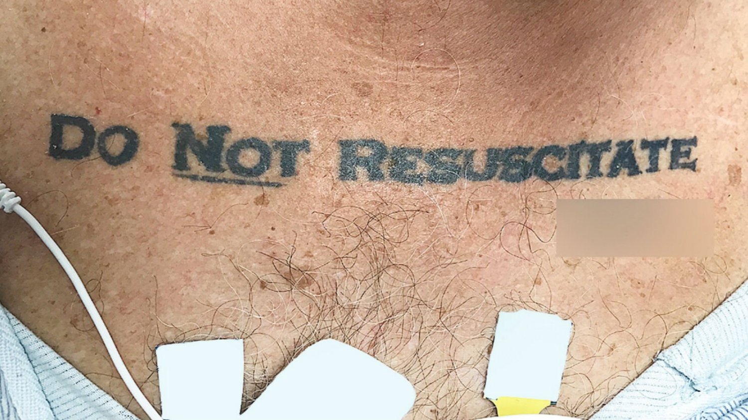 Татуировки реанимацию не проводить