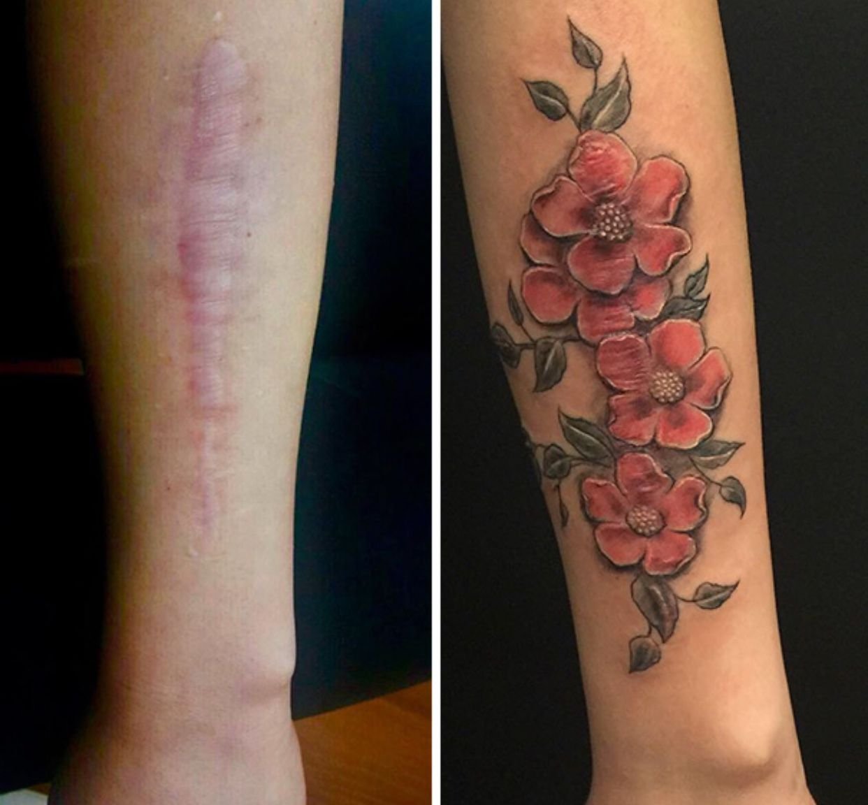 татуировки на шрамах на руке женские