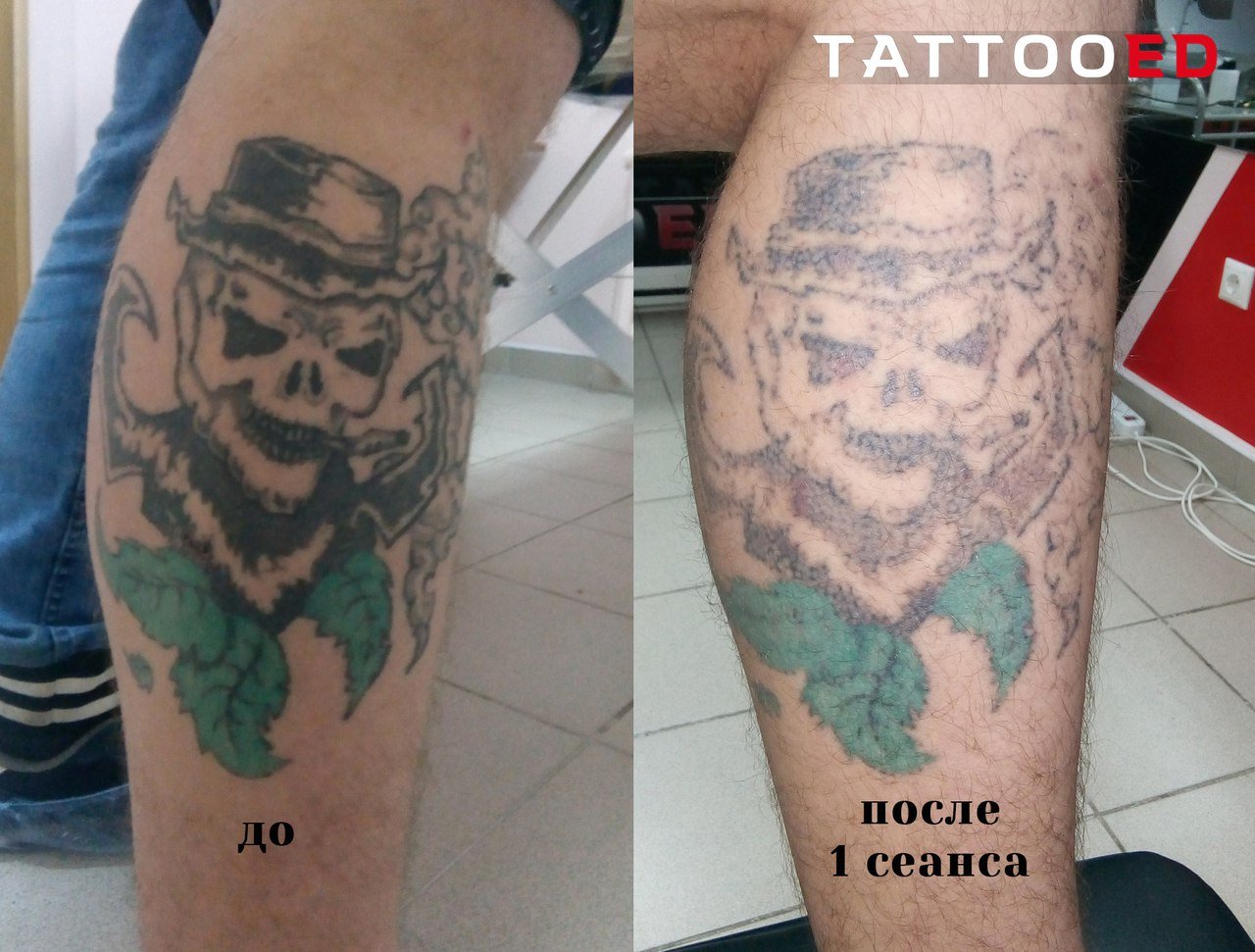 Зажившие Татуировки до и после