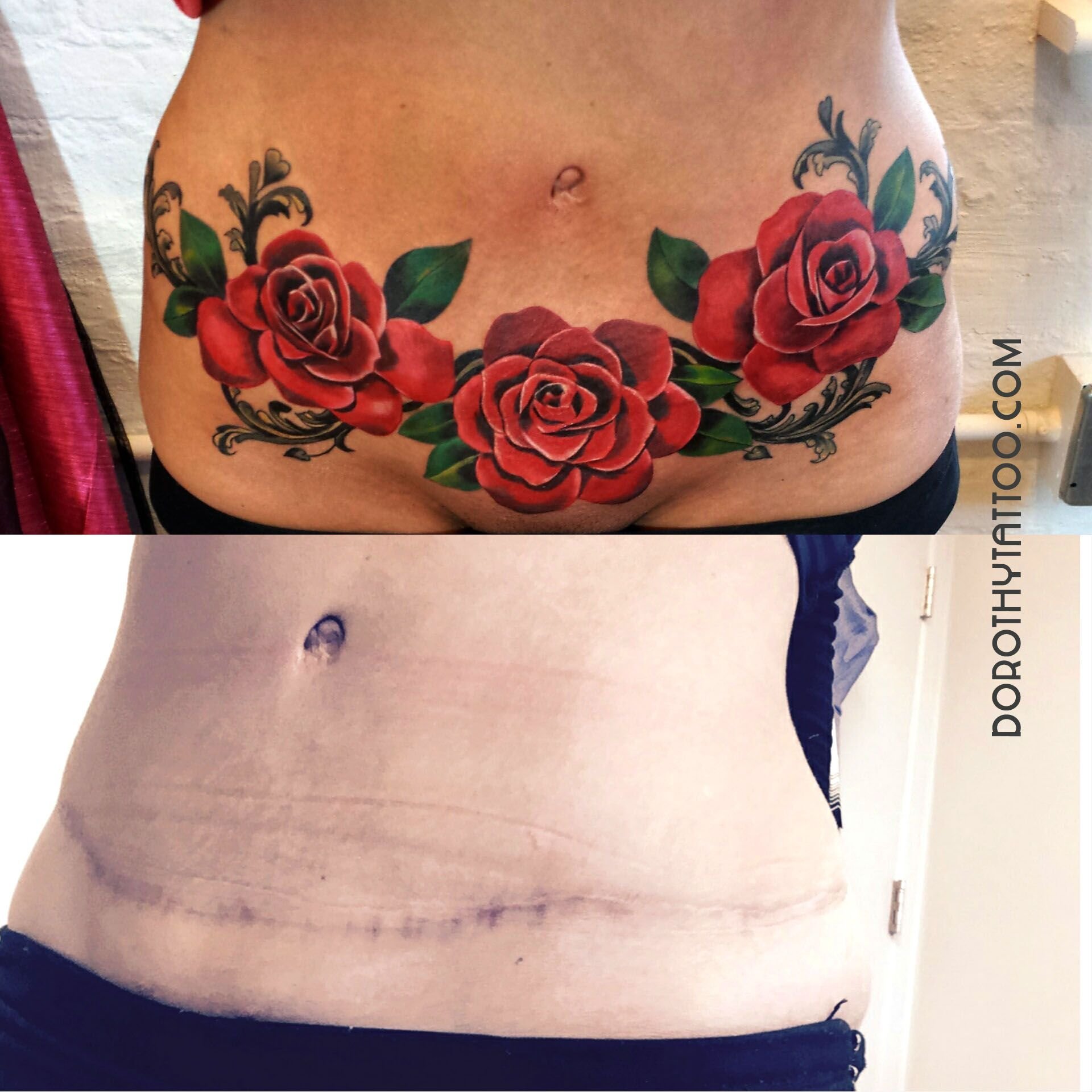 Татуировки для девушек на животе на шраме