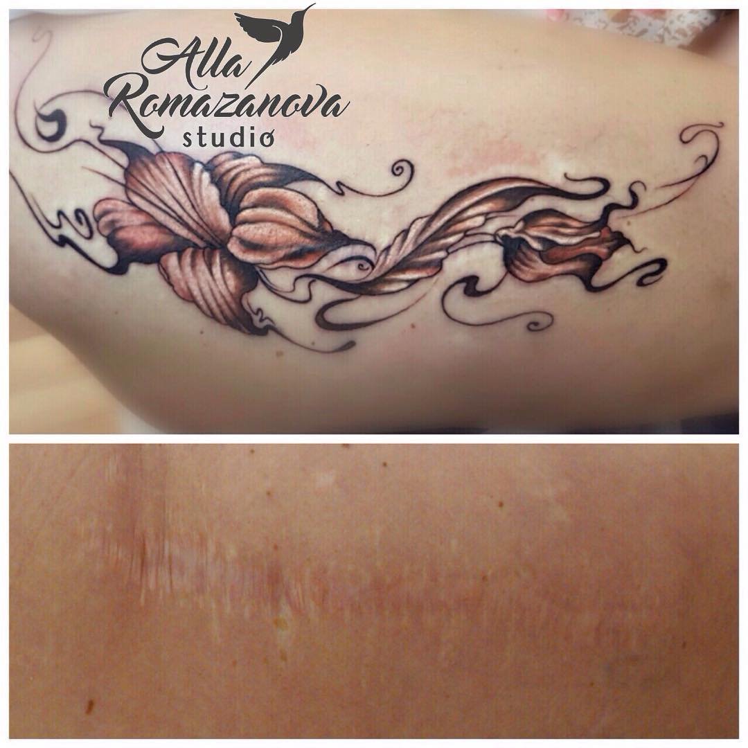Перекрытие шрамов татуировкой на спине