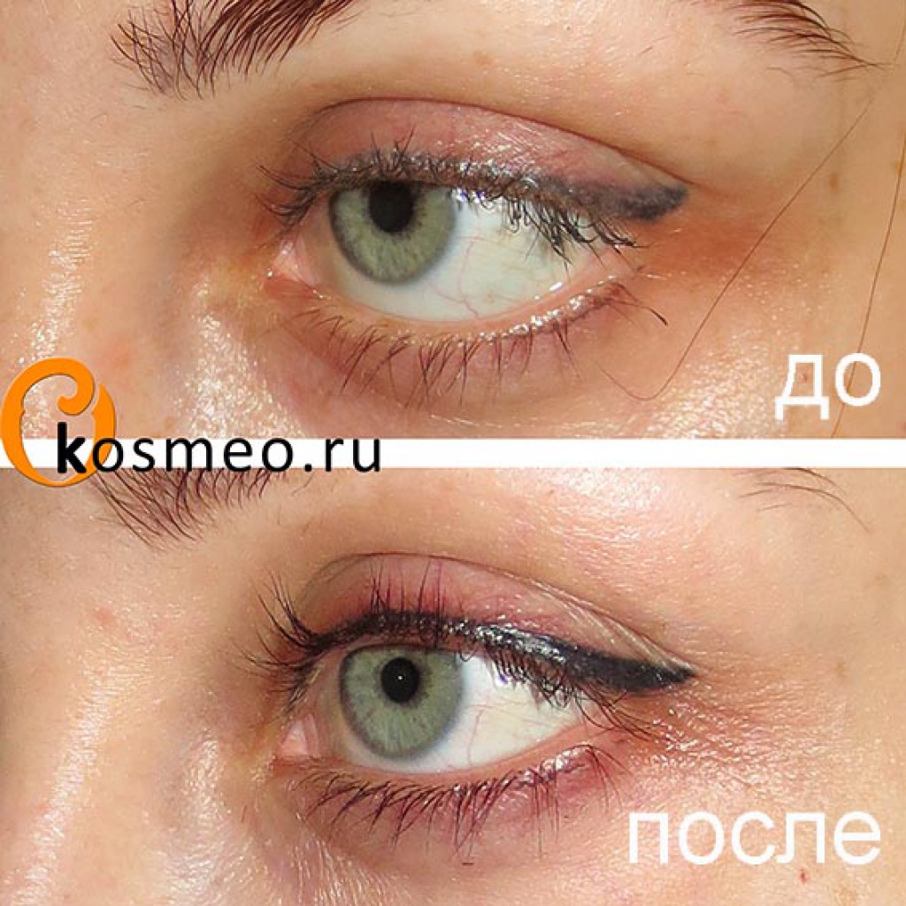 Перманентный макияж стрелки с растушевкой фото до и после