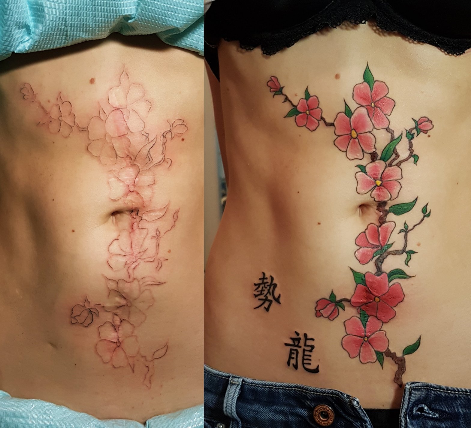 Перекрытие шрамов татуировкой на животе