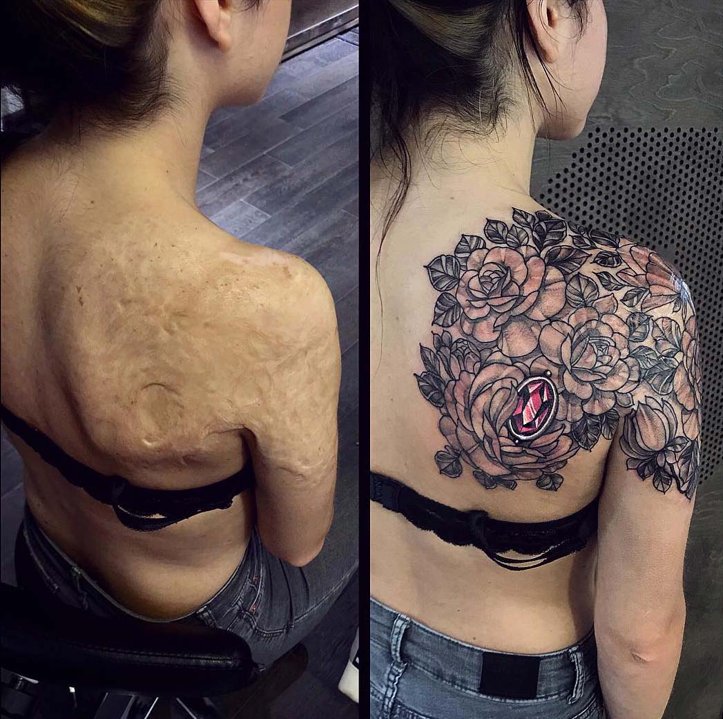 Перекрытие шрамов татуировкой на спине