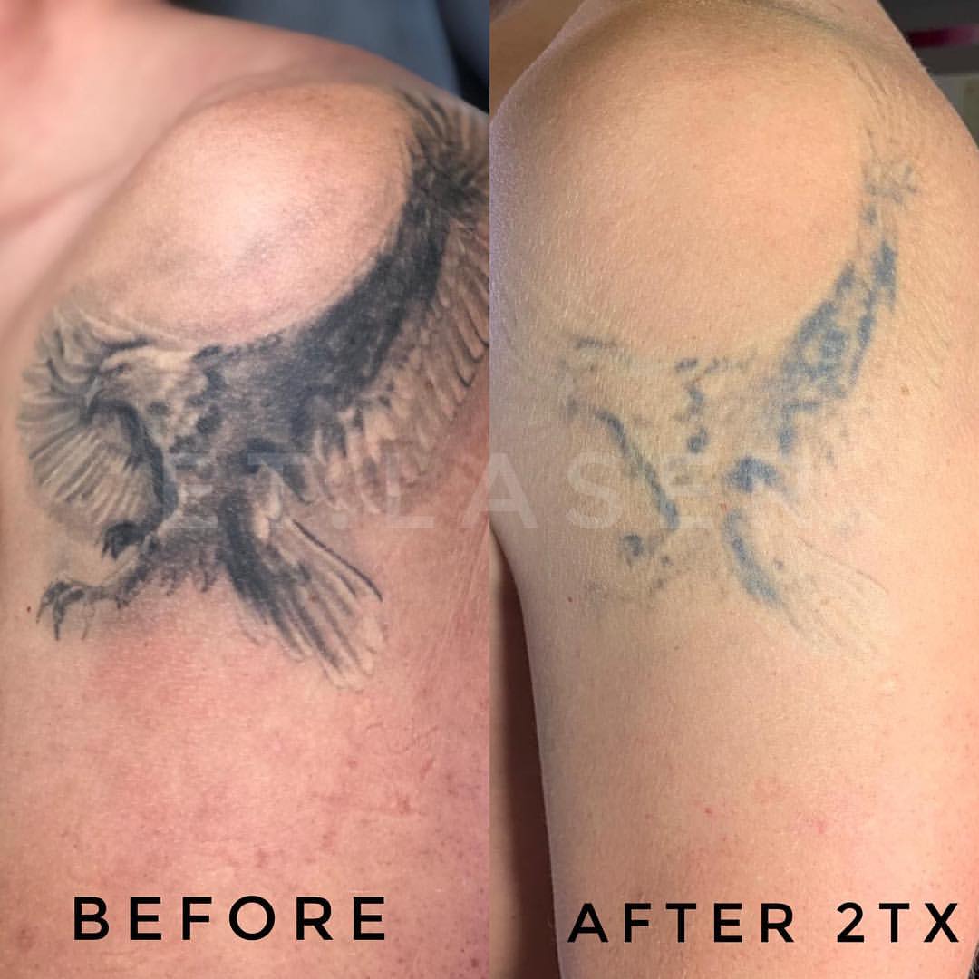 Татуировка до и после заживления