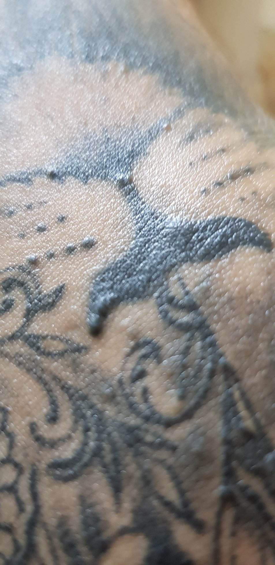 Маленькие пупырышки на татуировке