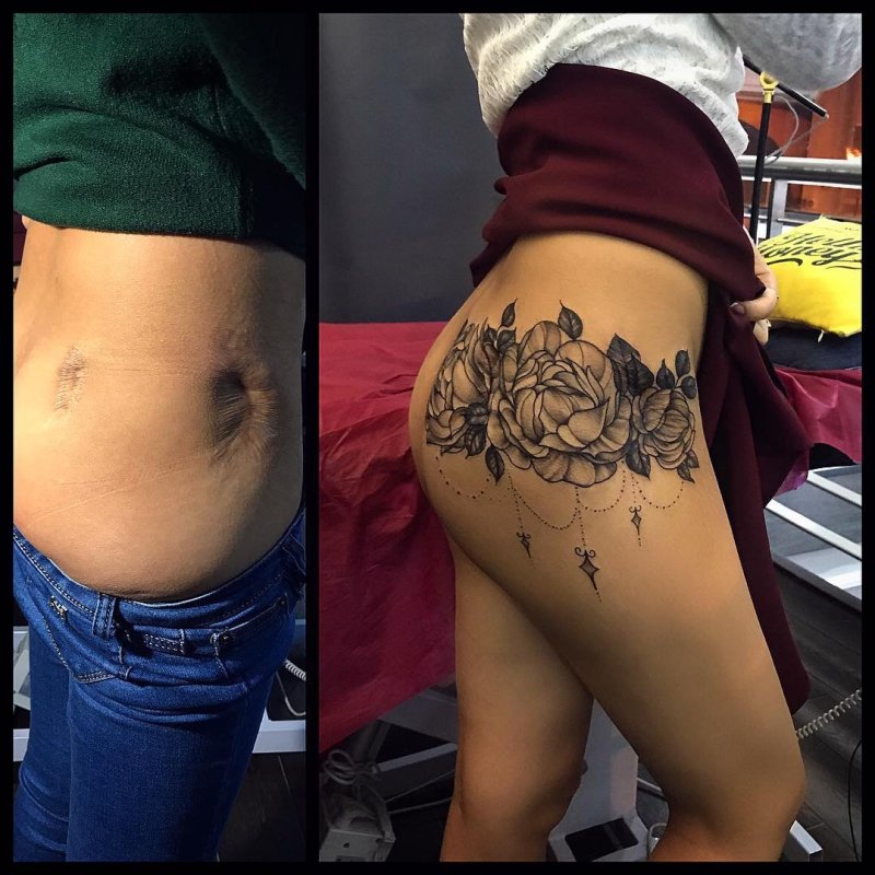 Татуировки на шрамах - фото перекрытия тату рубцов | Tattoo Academy