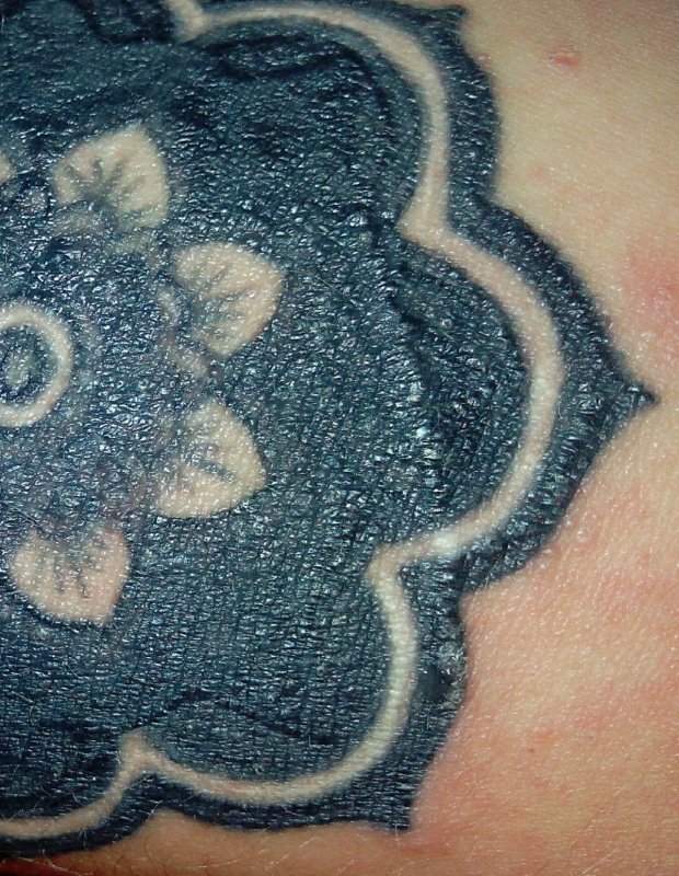 Аллергия на татуировки | VER SACRUM TATTOO | Дзен