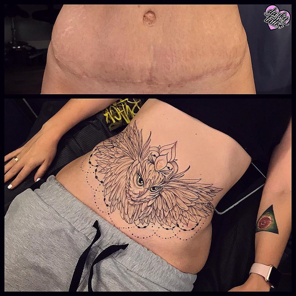 Татуировки для девушек на животе на шраме