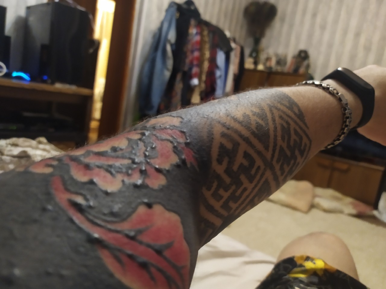 Прыщи на татуировке